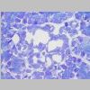 Pancreas SF 24.jpg